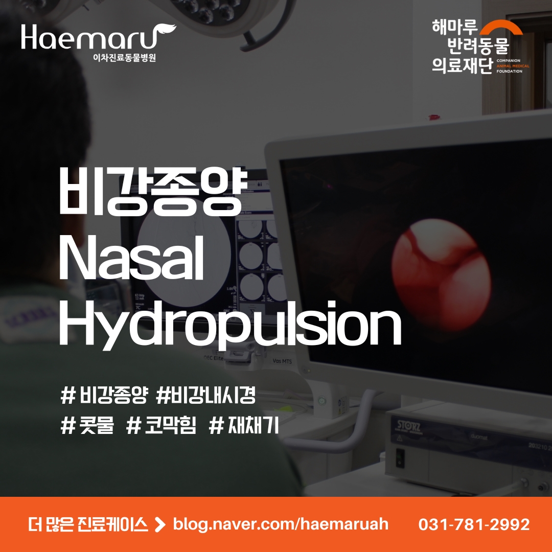 비강종양에서 내시경을 통한 Nasal Hydropulsion 치료 경과 썸네일